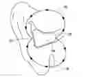 Fig. 01 - Entrainment avoidance with an auto regressive filter
