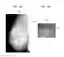 Fig. 04 - Lesion classification apparatus, and method of modifying lesion classification data
