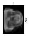 Fig. 04 - Method and system for user interaction in 3-D cephalometric analysis