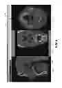 Fig. 06 - Method and system for user interaction in 3-D cephalometric analysis