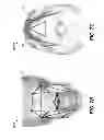 Fig. 09 - Method and system for user interaction in 3-D cephalometric analysis