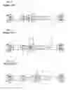 Fig. 07 - Fall-off preventing structure of propeller shaft