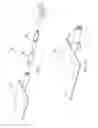 Fig. 02 - Modular long handled tool component system
