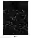 Fig. 08 - Method of Delivering Therapeutics and Imaging Agents to the Brain by Nanoparticles that Cross the Blood Brain Barrier