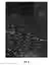 Fig. 10 - Method of Delivering Therapeutics and Imaging Agents to the Brain by Nanoparticles that Cross the Blood Brain Barrier