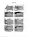 Fig. 04 - Methods of Blocking Ultraviolet Radiation and Promoting Skin Growth Using Terpenes and Terpenoids
