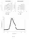 Fig. 05 - Reverse thermal gels and their use in cell therapy