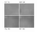 Fig. 13 - Reverse thermal gels and their use in cell therapy