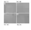 Fig. 15 - Reverse thermal gels and their use in cell therapy