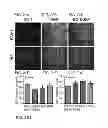 Fig. 19 - Reverse thermal gels and their use in cell therapy