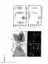 Fig. 02 - Method to modulate pigmentation process in the melanocytes of skin