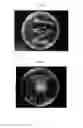 Fig. 02 - Method for inhibiting proliferation of plant pathogenic microbe using bacterium