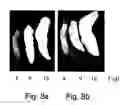 Fig. 09 - Agent derived from tortoise spleen stimulating mammalian hemopoiesis