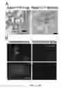 Fig. 04 - METHODS OF TREATING RICKETTSIA USING EXCHANGE PROTEINS DIRECTLY ACTIVATED BY CAMP (EPACS) INHIBITORS
