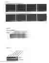 Fig. 14 - COMBINATORIAL METHODS AND COMPOSITIONS FOR TREATMENT OF MELANOMA