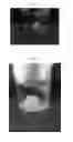 Fig. 06 - Polymeric Drug-Delivery Material, Method For Manufacturing Thereof And Method For Delivery Of A Drug-Delivery Composition
