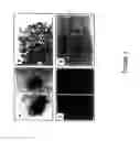 Fig. 04 - Mesenchymal precursor cell