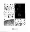 Fig. 13 - Mesenchymal precursor cell