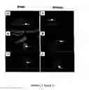 Fig. 19 - Mesenchymal precursor cell