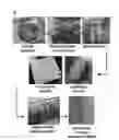 Fig. 01 - Amniotic membrane hydrogel and methods of making