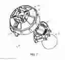 Fig. 08 - Spacer mold for orthopedic implants
