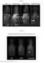 Fig. 07 - DTPA DERIVATIVE, METAL COMPLEX, MR AND CT CONTRAST AGENT AND METHOD FOR MANUFACTURING SAME