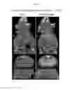 Fig. 09 - DTPA DERIVATIVE, METAL COMPLEX, MR AND CT CONTRAST AGENT AND METHOD FOR MANUFACTURING SAME