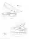Fig. 02 - Oral cavity suction device