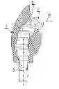 Fig. 01 - Channel formation for the fixing element of a dental superstructure and method of making the same