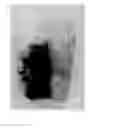 Fig. 01 - Oral composition for removing tooth stain