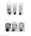 Fig. 02 - Oral composition for removing tooth stain