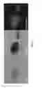 Fig. 03 - METHOD AND KIT FOR PROTOZOA CHARACTERIZATION