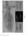 Fig. 04 - METHOD AND KIT FOR PROTOZOA CHARACTERIZATION