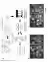 Fig. 02 - Non-invasive imaging to the blastocyst stage for the detection of human embryonic aneuploidy