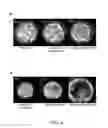 Fig. 06 - Non-invasive imaging to the blastocyst stage for the detection of human embryonic aneuploidy