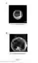 Fig. 08 - Non-invasive imaging to the blastocyst stage for the detection of human embryonic aneuploidy