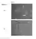 Fig. 43 - Compositions and Methods Relating to Clonal Progenitor Cells