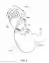 Fig. 06 - CONTAINERIZED HAND PUPPET EMBODYING MULTIPLE TOY FIGURES