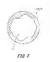 Fig. 08 - Golf club head