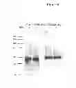 Fig. 08 - T cell receptor display