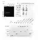 Fig. 08 - METHODS OF DIAGNOSING AND TREATING AMYOTROPHIC LATERAL SCLEROSIS