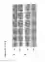 Fig. 45 - Methods for reducing oxidative damage