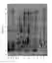 Fig. 02 - MATERIALS AND METHODS FOR DETECTING AND/OR PREDICTING NECROTIZING ENTEROCOLITIS IN INFANTS