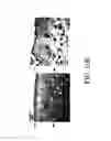 Fig. 10 - Compositions and methods for treating neoplastic diseases