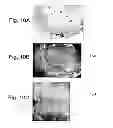 Fig. 07 - COMPOSITIONS AND THEIR USES FOR GENE THERAPY OF BONE CONDITIONS