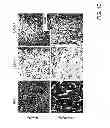 Fig. 04 - COMPOSITIONS AND METHODS FOR MODULATING ANGIOGENESIS