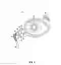 Fig. 03 - Sustained release delivery of active agents to treat glaucoma and ocular hypertension