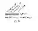 Fig. 13 - Uses of histone acetyltransferase activators