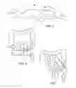 Fig. 04 - Patient colonoscopy abdominal compression device and method