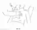 Fig. 05 - Patient colonoscopy abdominal compression device and method